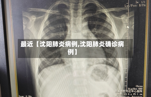 最近【沈阳肺炎病例,沈阳肺炎确诊病例】-第3张图片