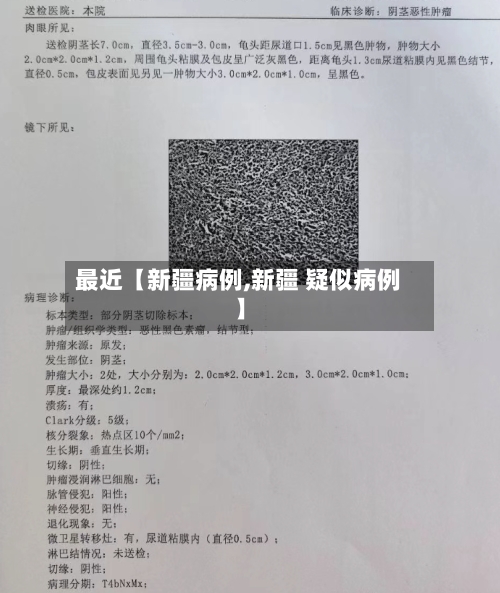 最近【新疆病例,新疆 疑似病例】-第2张图片